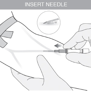 Intravenous Catheter Insertion