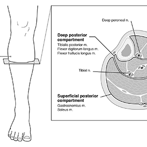 Lower Limb Compartment Testing